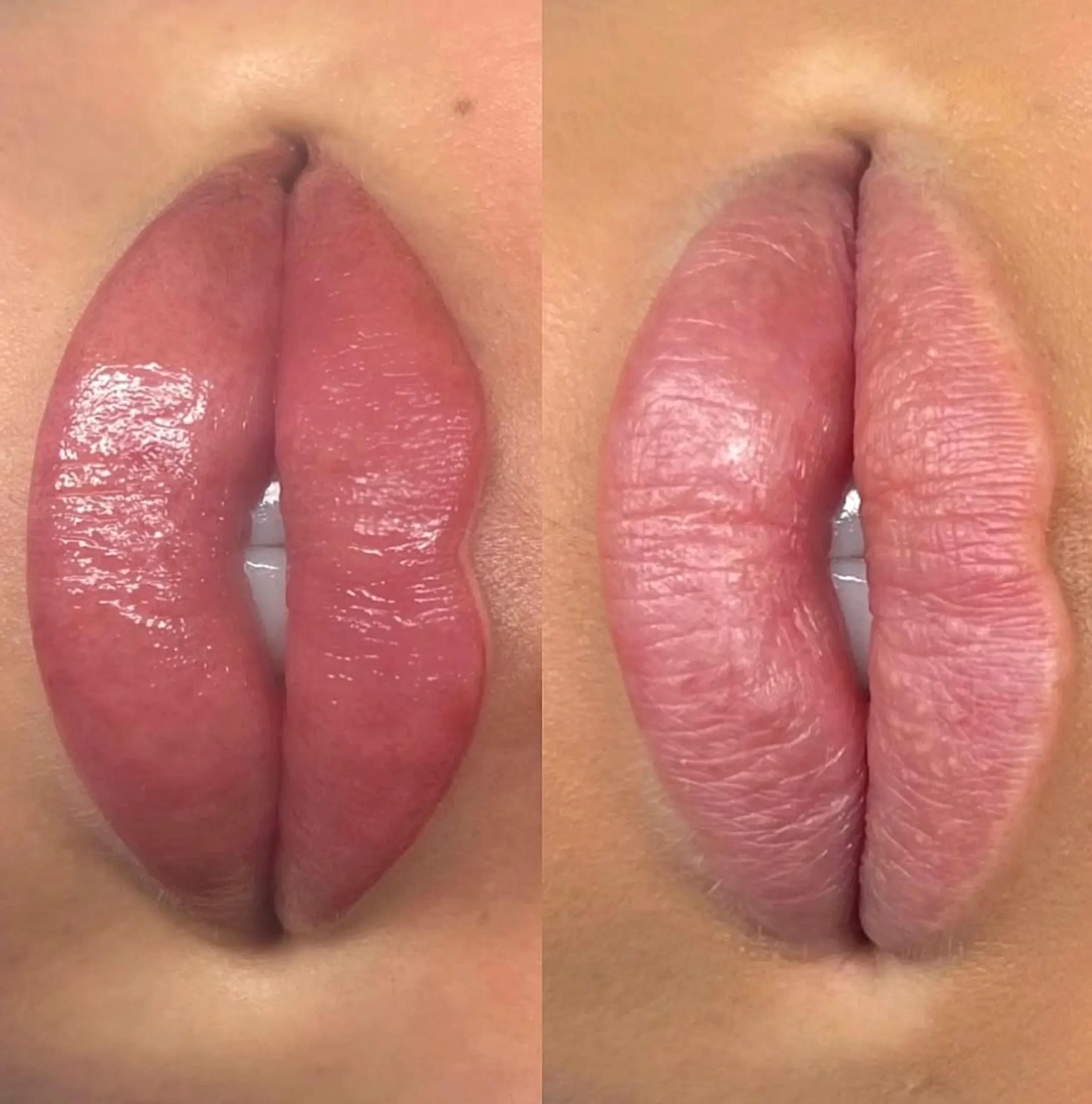 cosmetic lip tattoo before and after