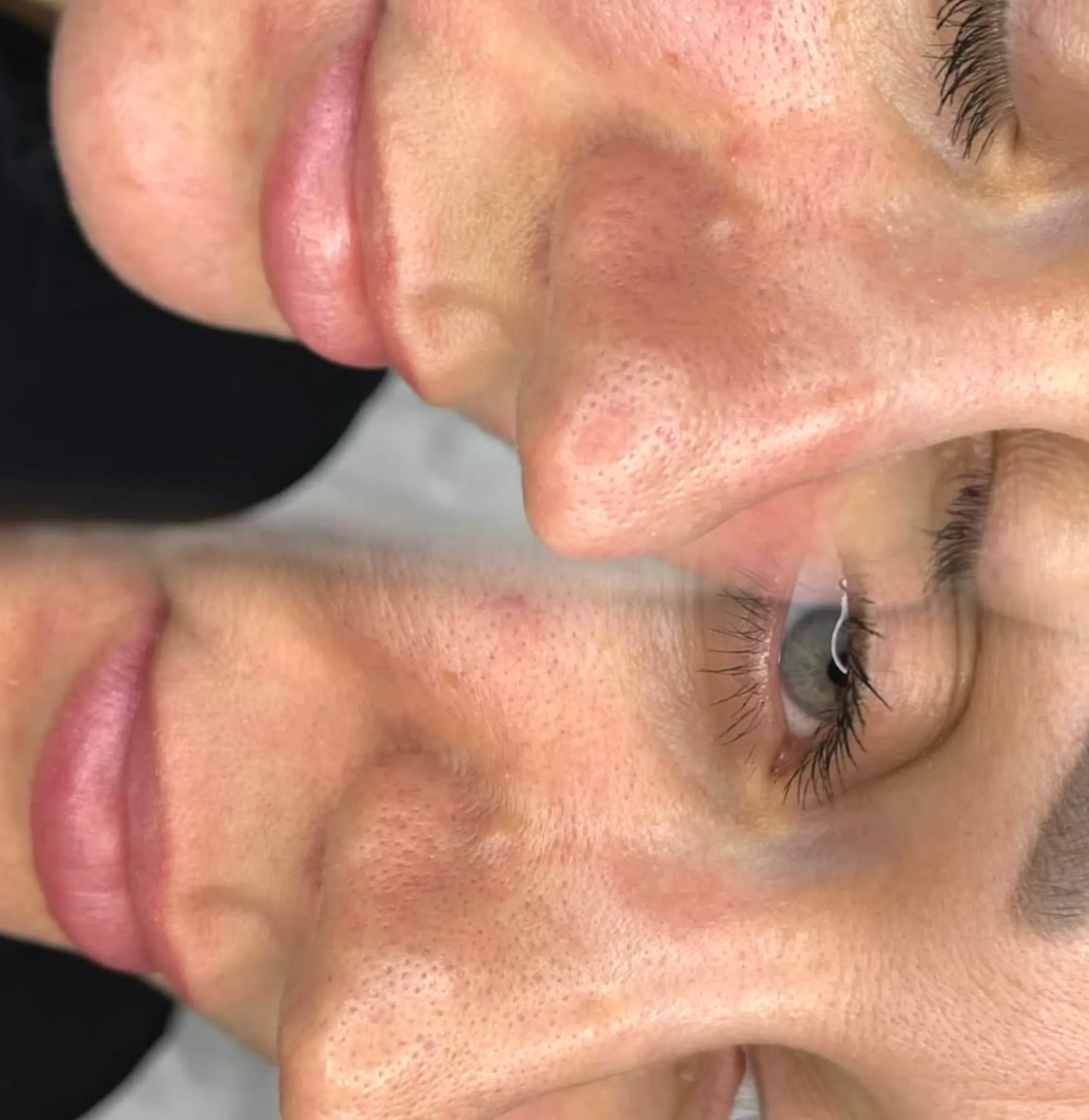 best vitamins for skin glow