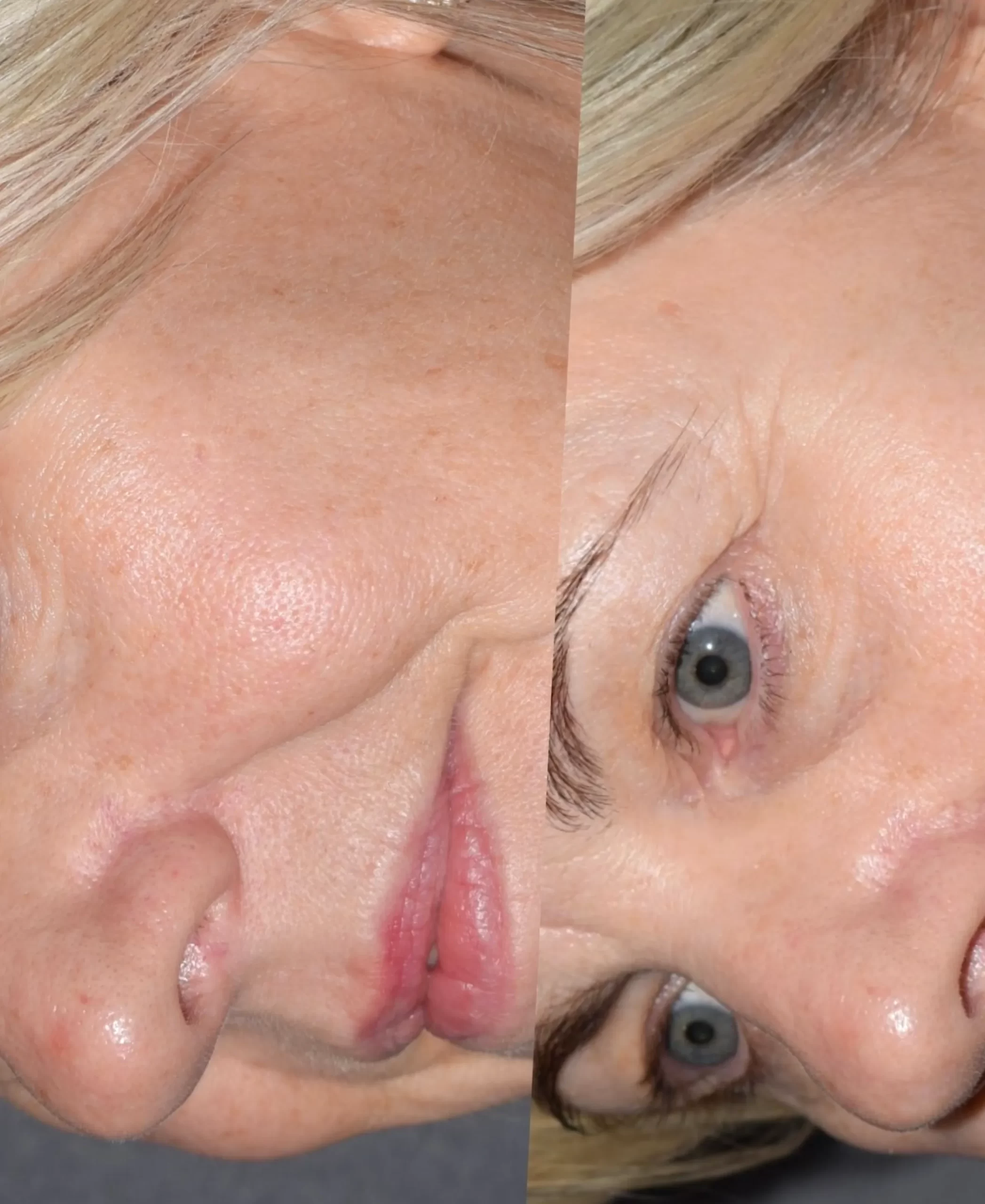 vitamin A for skin texture