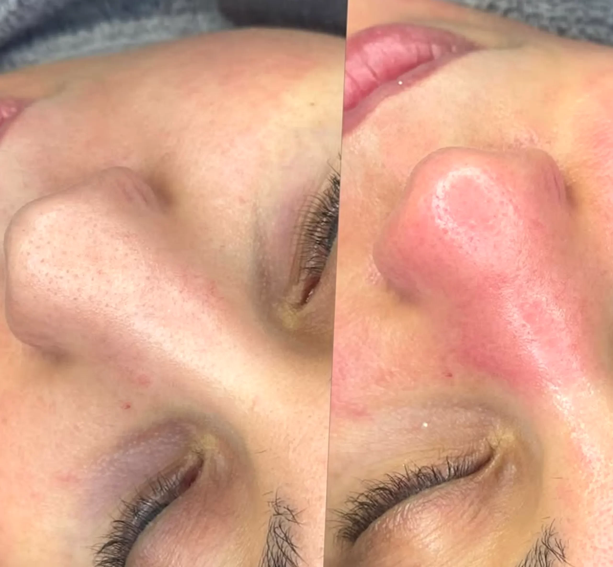 vitamin C for skin radiance