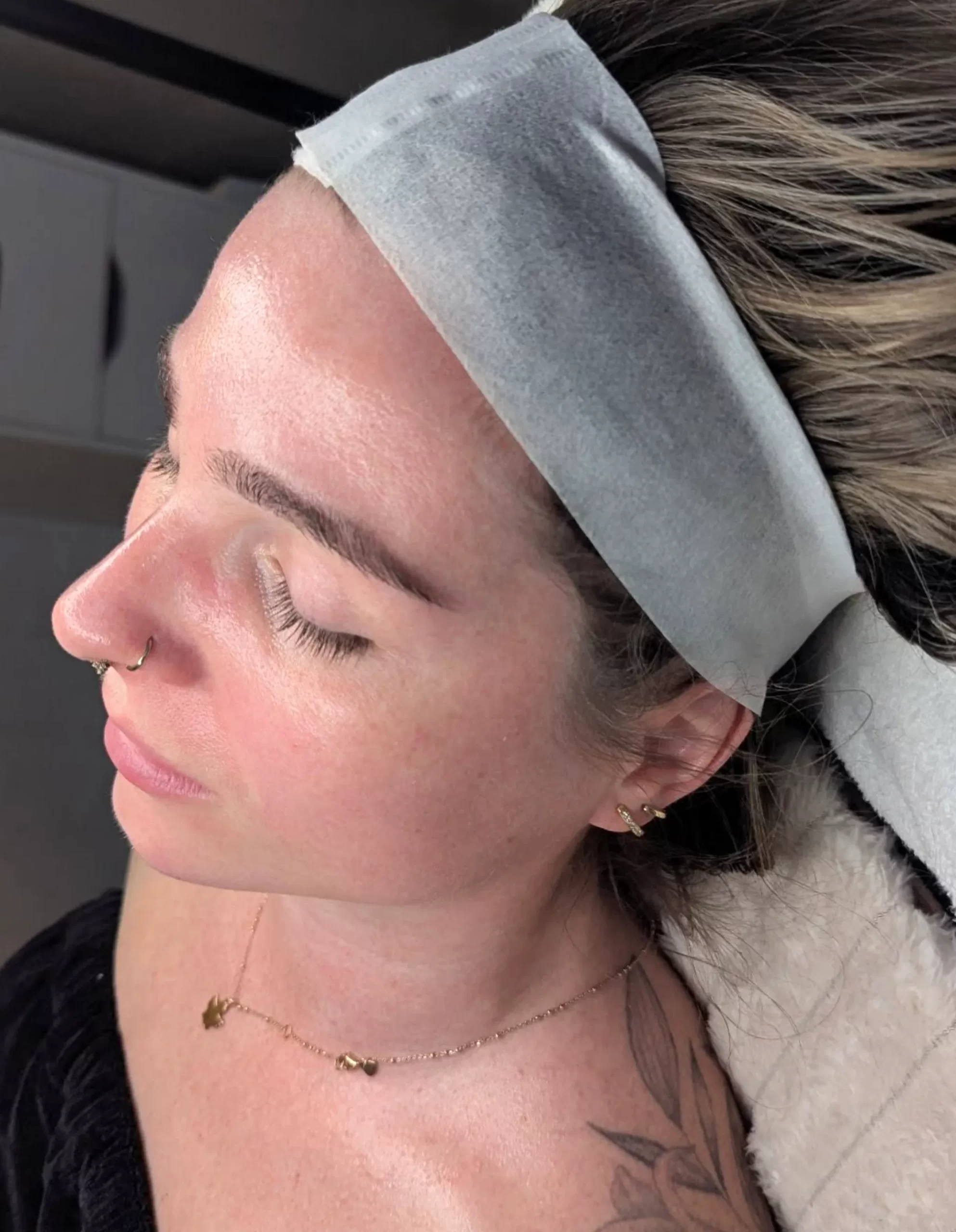 vitamin E and skin health