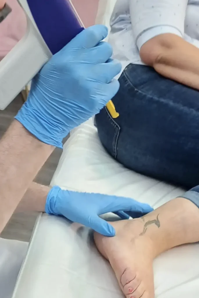 tattoo removal qualifications uk