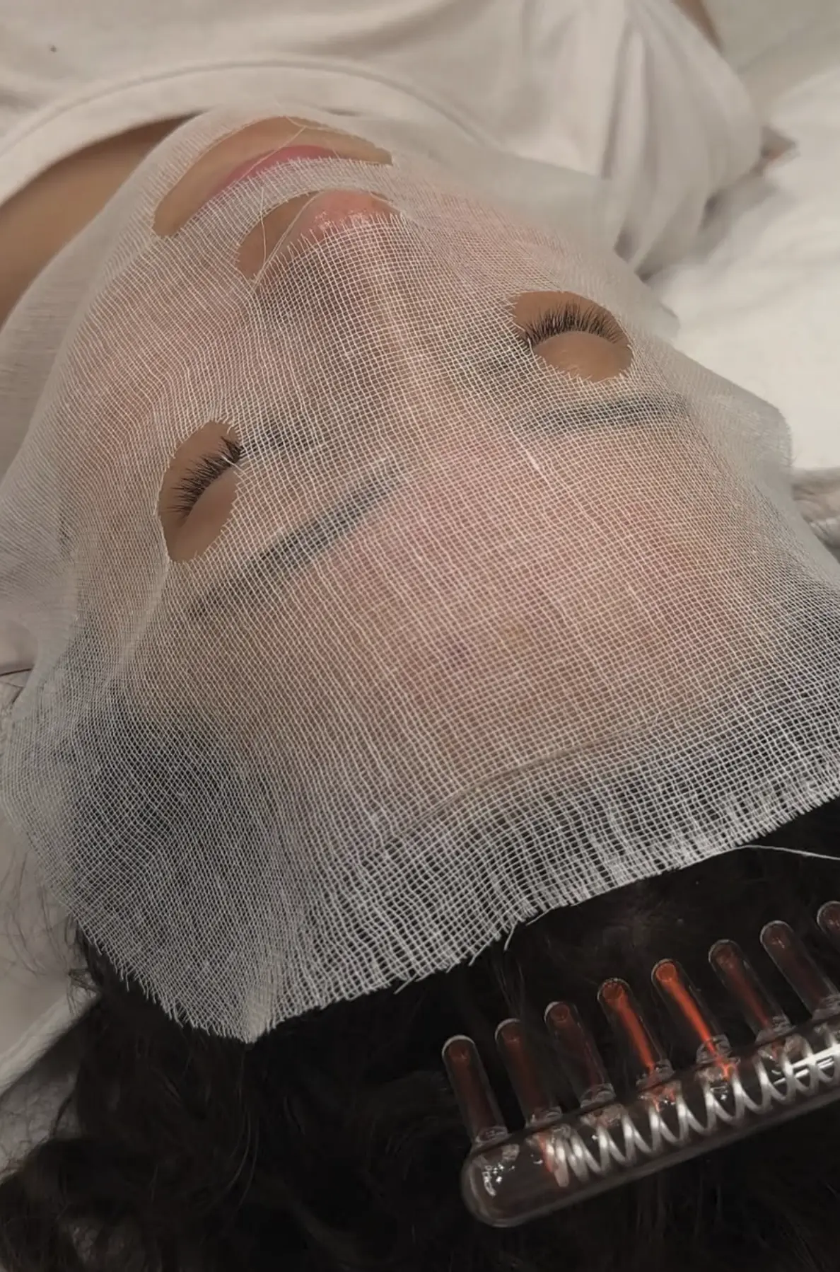 vampire facial brisbane
